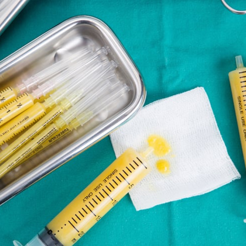 Fat Injection (Lipofilling) for Natural Volume Restoration – Dr. Jale Özdemir