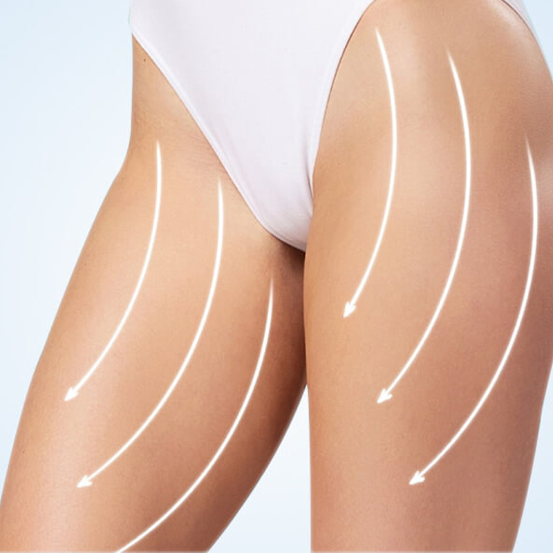 Op. Dr. Jale Özdemir Bacak Şekillendirme Estetiği